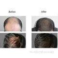 Анти -выпадение волос сырье 99% RU58841 Порошок